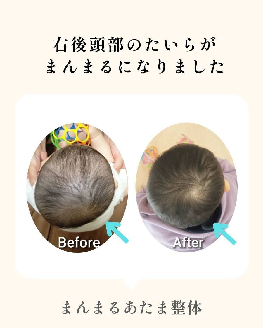 変化の記録 1