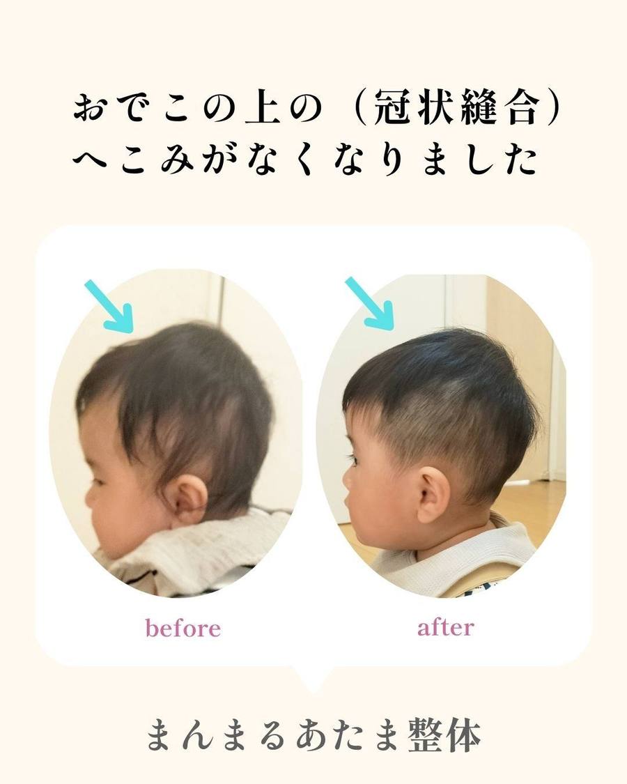 変化の記録 6
