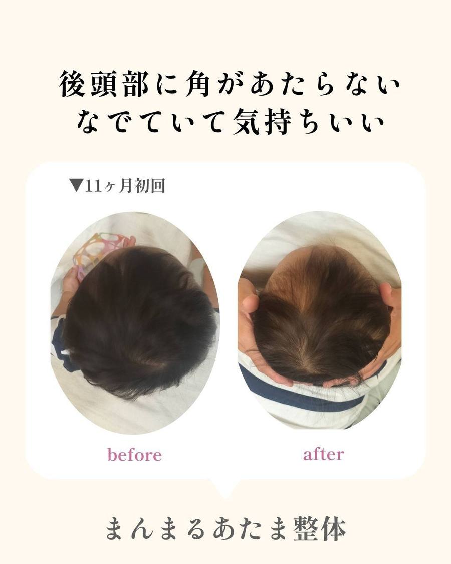 変化の記録 9