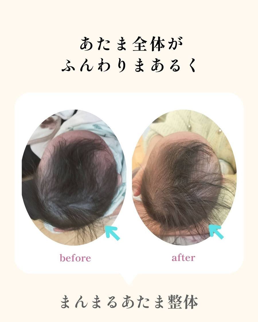 変化の記録 18